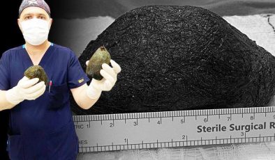 Korkunç alışkanlığı başına bela oldu! Midesinden çıkanlar şok etti