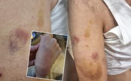 Zihinsel engelli öğrenciye öğretmen şiddeti: İşkence görmüş, dayak değil
